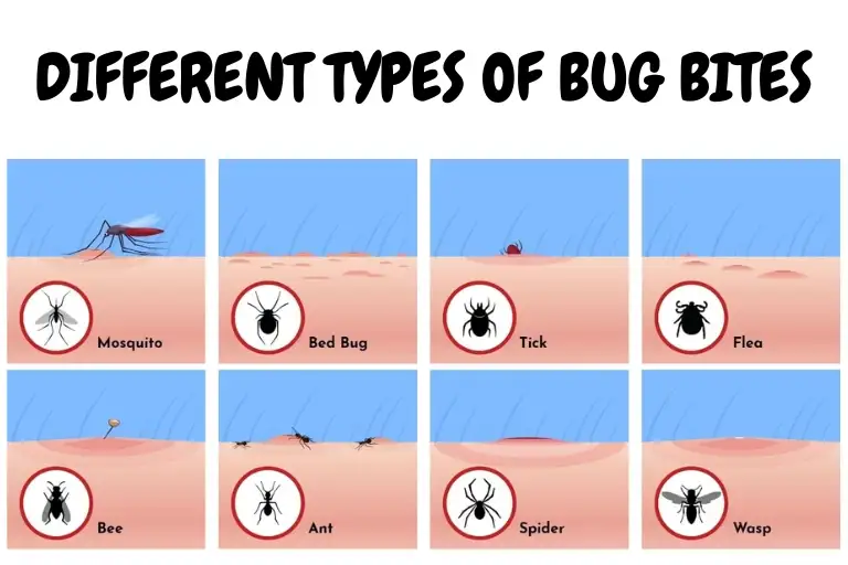 different types of bug bites and how to treat them