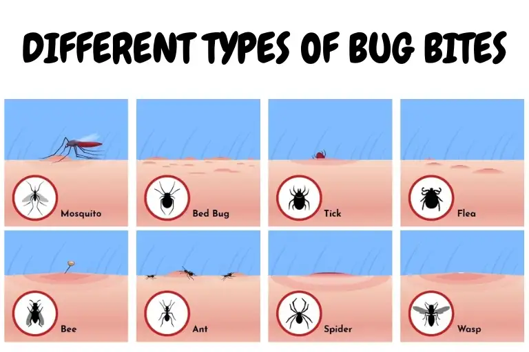 Different Types Of Bug Bites And How To Treat Them
