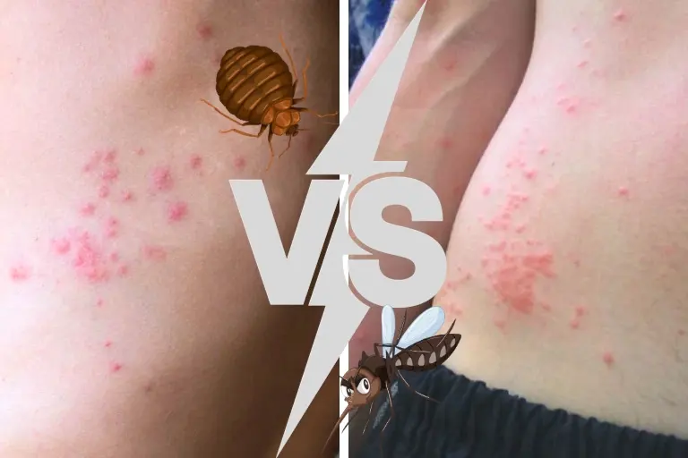 how to distinguish bed bug bites vs. mosquito bites